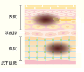 アトピスマイル 色素沈着